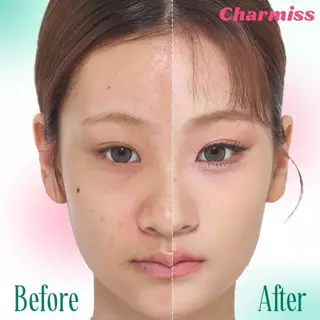 Charmiss Matte All Day Acne Cushion SPF 50 PA++++ คุชชั่นชาร์มิส 1 ซอง