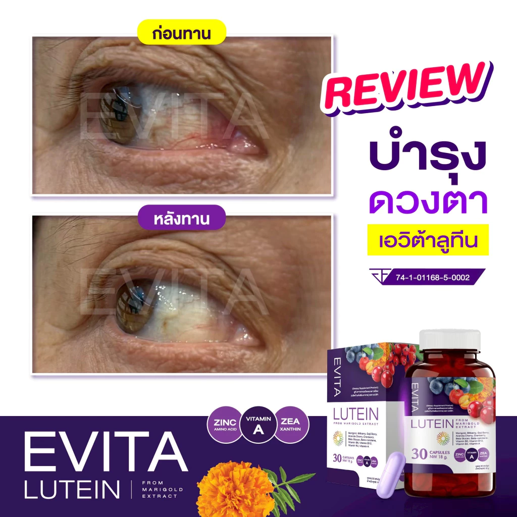 EVITA LUTEIN เอวิต้าลูทีน วิตามิน บำรุงดวงตา บำรุงสายตา ลูทีน thumbnail 4