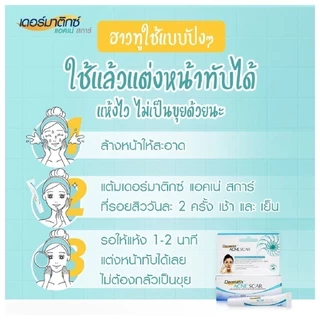 Dermatix Ultra Gel 5g และ Dermatix Acne Scar เดอร์มาติกซ์แอคเน่สการ์ 5g.