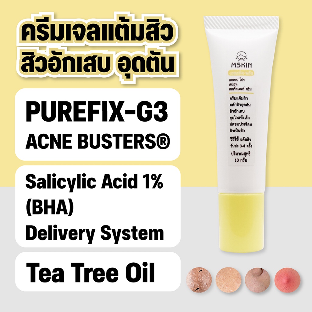แอคเน่ โปร สปอท คอเร็คเตอร์ ครีมเจลแต้มสิว อุดตัน อักเสบ สิวยุบไว แห้งเร็ว AC01