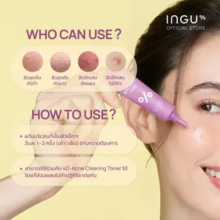 INGU Anti Acne Gel เจลแต้มสิว สำหรับผิวที่มีแนวโน้มเป็นสิว