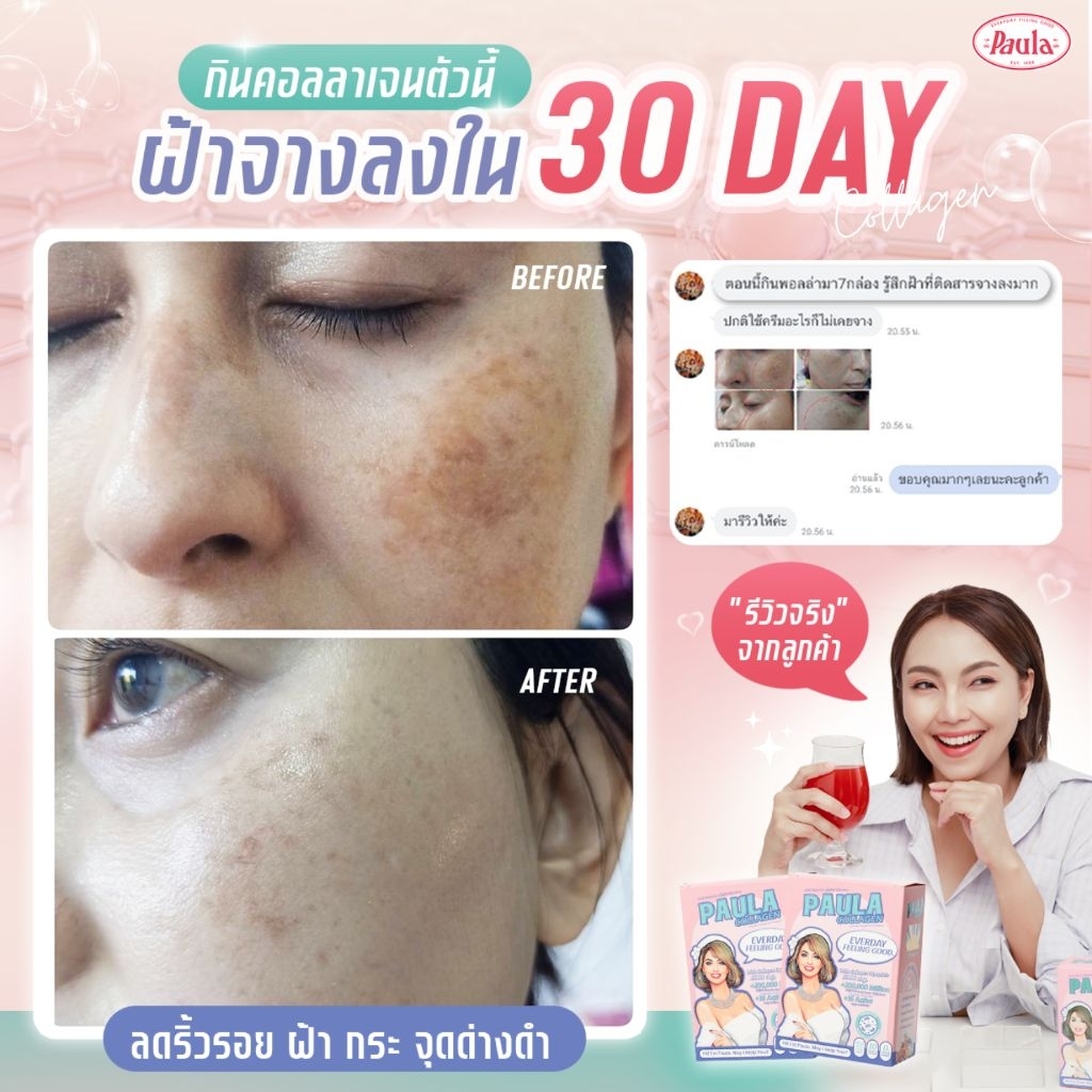 พอลล่าคอลลาเจน6กล่อง แก้ปัญหาเรื่องฝ้า ฝ้าจางลง