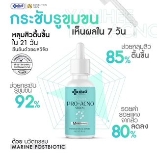 Yanhee Pro Acno Serum ยันฮี โปรแอกโน่ เซรั่ม ลดสิว ผิวมัน สิวผด สิวไม่มีหัว สิวฮอร์โมน