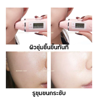 3กล่อง 90ชิ้น🔥VENZEN เซรั่มบำรุงผิวหน้า บำรุงผิวชุ่มชื้น เหมาะสำหรับคนที่มีปัญหา จุดด่างดำ ริ้วรอยดูจางลง ผิวกระจ่างใส
