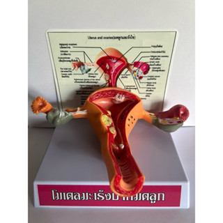 โมเดลสำหรับสาธิตการตรวจมะเร็งปากมดลูก