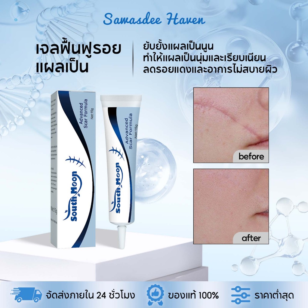 South Moon เจลฟื้นฟูรอยแผลเป็น เจลลดรอยแผลจากสิว สการ์เจล เจลฟื้นฟูรอยแผลเป็น ปรับปรุงรอยแผลเป็น บรรเทาและฟื้นฟู
