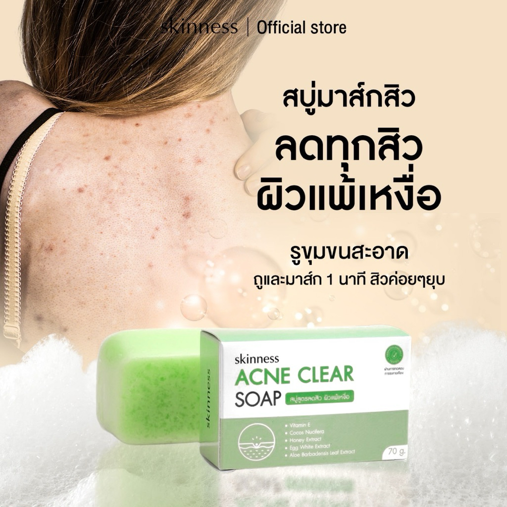 ใหม่! [พร้อมส่งทุกวัน] skinness acne clear soap | สบู่มาส์กสิวลดทุกปัญหาสิว