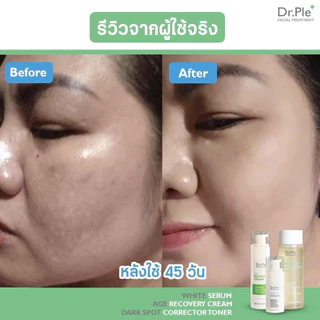 Dr.Ple โทนเนอร์เช็ดฝ้า เซรั่มฝ้า ครีมชุ่มชื้น ริ้วรอย โฟม | บำรุงผิวครบ ดร.เปิ้ล