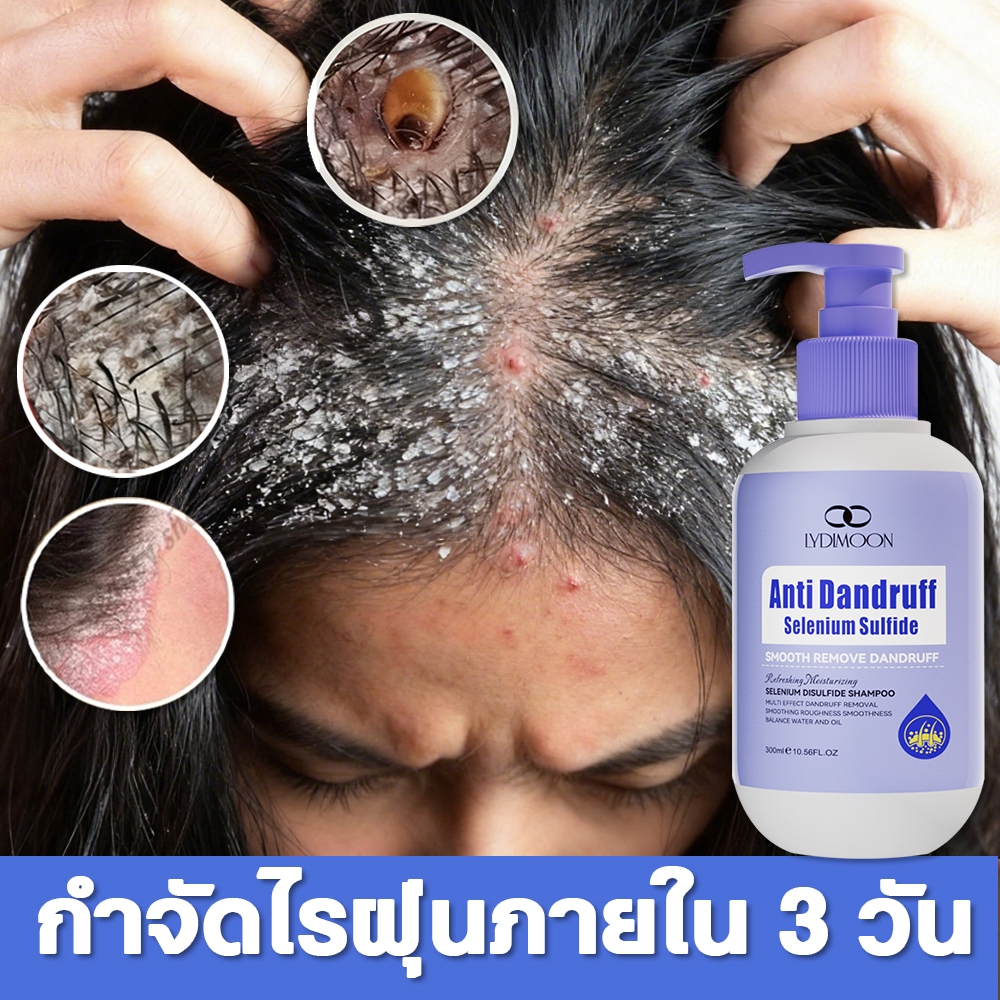 LYDIMOON แชมพูซีลีเนียมไดซัลไฟด์ 300ml ควบคุมความมัน ขจัดรังแค ลดอาการคันศีรษะ ลดผมร่วง บํารุงรากผม 