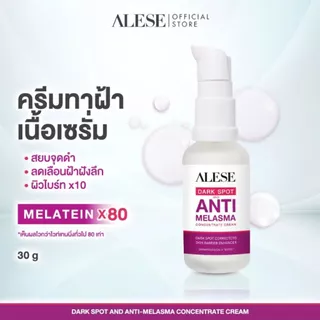 (โปรเดือน 8.8.) ALESE Dark Spot And Melasma Concentrate Cream 30 g ครีมเนื้อเซรั่มสูตรเข้มข้น ดูเเลฝ้า รอยดำรอยเเดงดูจ