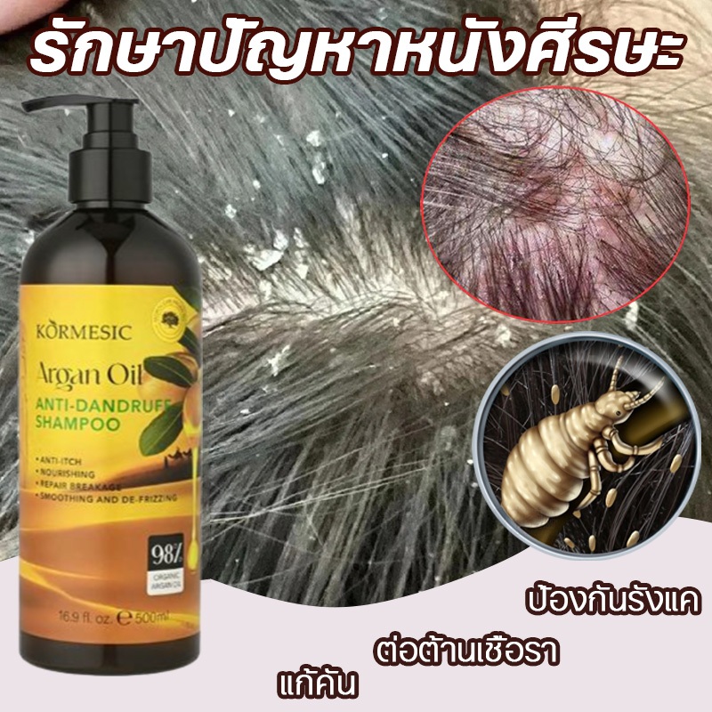 Shampoo ยาสระผม แชมพูขจัดรังแค แชมพูสระผมนุ่มลื่น 500ml ป้องกันรังแคและคัน ยาสระผมคุมน้ำมันแก้คันขจัดรังแค