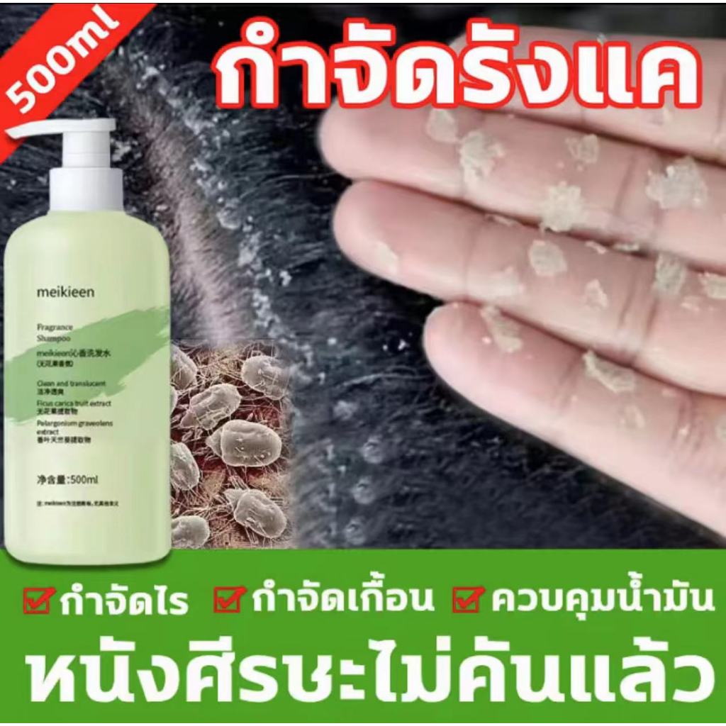 269h7kicwt*แชมพูขจัดรังแค 3วันไม่มัน ความจุขนาดใหญ่500ml.ผมมันเยิ้มรังแคใช้ดีกว่า รังแค คัน ผมมัน แห้งและชี้ฟู เอสเซนส์ม