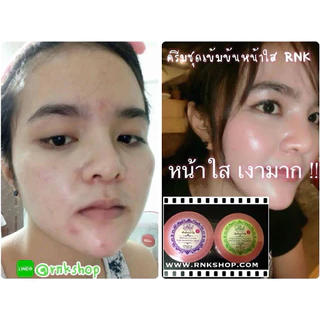 RNKครีมชุดเข้มข้นหน้าใส2กระปุกก่อนนอน