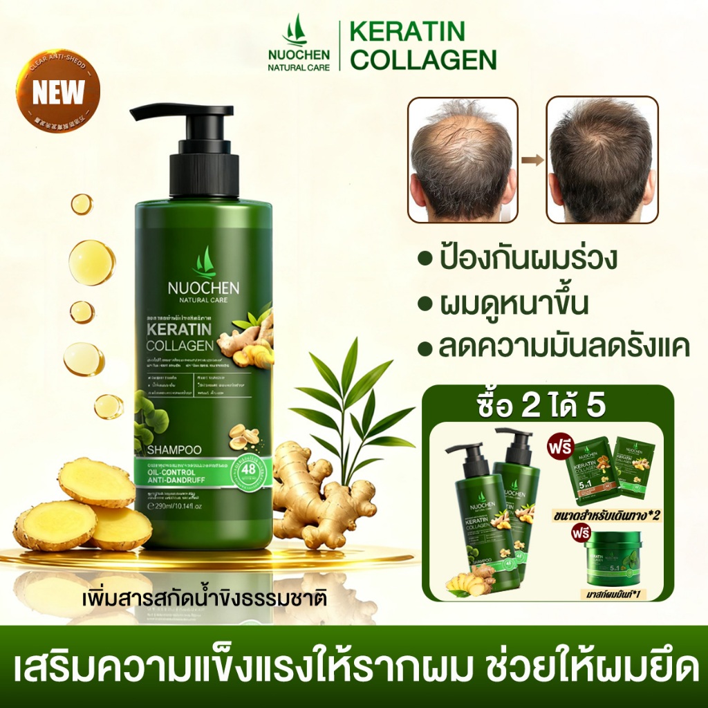 【ซื้อ 2 ได้ 5】แชมพูขิง แชมพูแก้ผมร่วง 300ML ป้องกันผมร่วง ยึดเกาะรา ผมให้แข็งแรง ผมดูหนาขึ้น