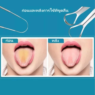 [ราคาต่ำสุด]ที่ขูดลิ้นโลหะ 3 ชิ้น ที่ขูดลิ้นสำหรับผู้ใหญ่ ลดกลิ่นปาก ลดแบคทีเรียในช่องปาก ที่ขูดลิ้นพกพา