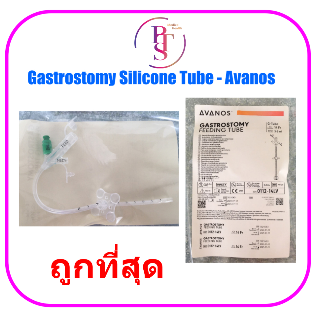 สายให้อาหารทางหน้าท้อง Gastrostomy Silicone Tube (PEG Tube) - Avanos