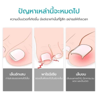 Hanaso ชุดมีดตัดเล็บขบ 3 ชิ้น Professional Pedicure Kit พร้อมกล่องพกพาสะดวก