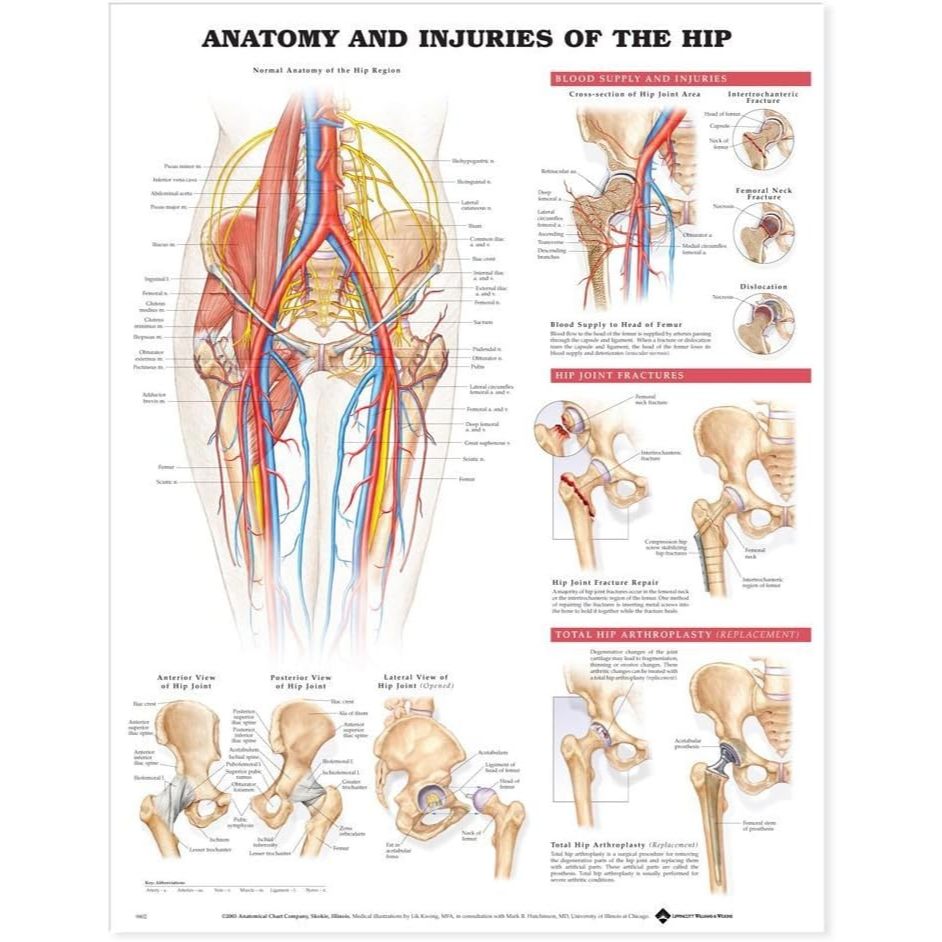 แผ่นโปสเตอร์ Anatomy and Injuries of the Hip Anatomical Chart (Paper) ed 1/2003