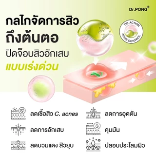 Dr.PONG 6H GENTLE ACNE LOTION แป้งน้ำแต้มสิว สิวยุบใน 1 คืน แห้งไว ไม่ทิ้งรอย ไม่ขึ้บนซ้ำ
