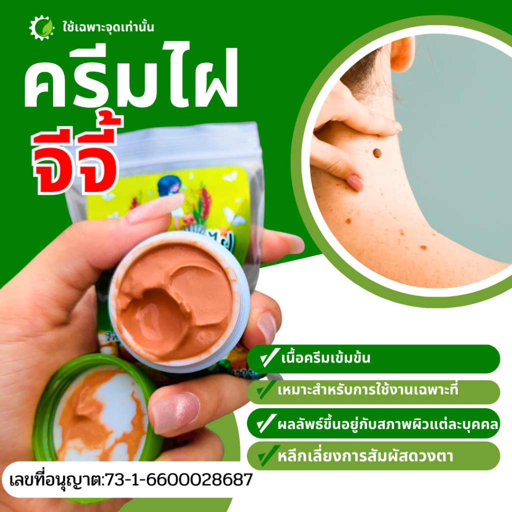 ครีมไฝ พร้อมส่ง ครีมไฝ จีจี้ ขี้แมลงวัน หูด ตาปลา ติ่งเนื้อ ไฝ ครีมแต้มไฝ แต้มไฝ ทาไฝ