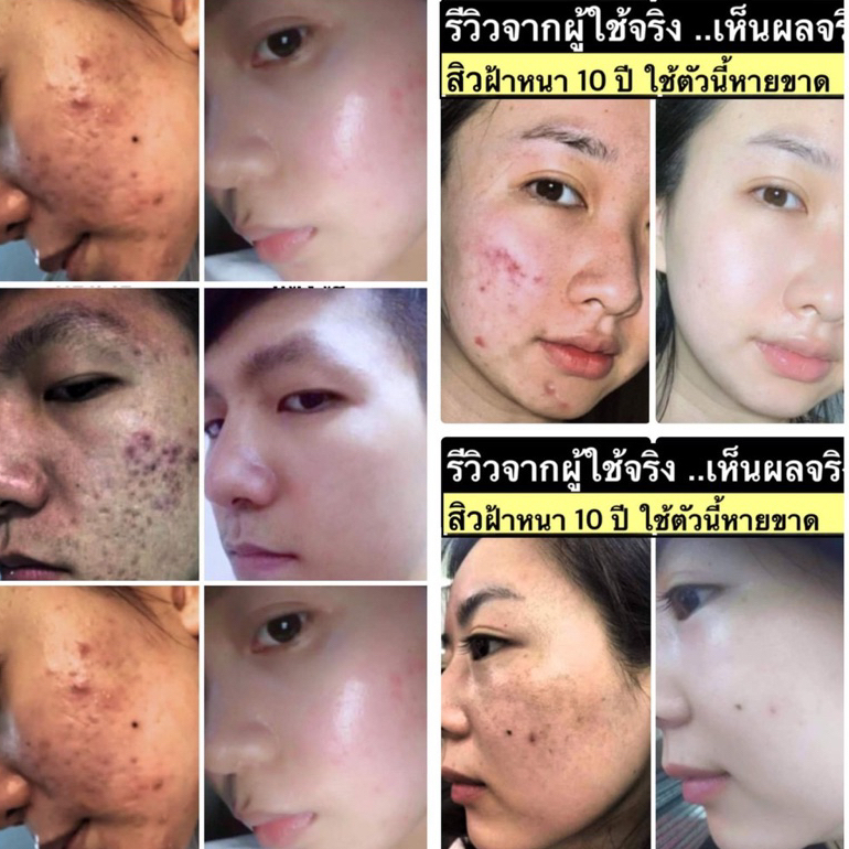 ⚡ของแท้💯 พร้อมส่ง⚡ CK ครีมแตงกวา ครีมฝ้า ครีมหน้าเงา ครีมฝ้า ครีมสิว ครีมหน้าเด้ง - รูปที่ 3