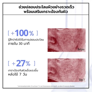 Formulogic: Panthenol-HA Soothing Ampoule Serum แอมพูลเซรั่มสำหรับการดูแลผิว ให้ผิวรู้สึกชุ่มชื้น สบายผิว และดูสุขภาพดี