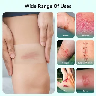 [ 100% แท้ /พร้อมส่ง] แผ่นไฮโดรคอลลอยด์เกรดแพทย์ม้วนเทปแพทช์ไฮโดรคอลลอยด์ สำหรับแผลเป็นสิวผิวทั้งหมด