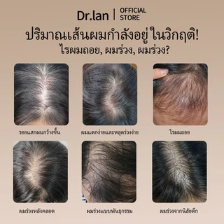 Dr.Lan เซ็ตลดผมร่วง แชมพูโรสแมรี่ + เซรั่มบำรุงผม งาดำ สำหรับผมร่วง ผมบาง บำรุงรากผม