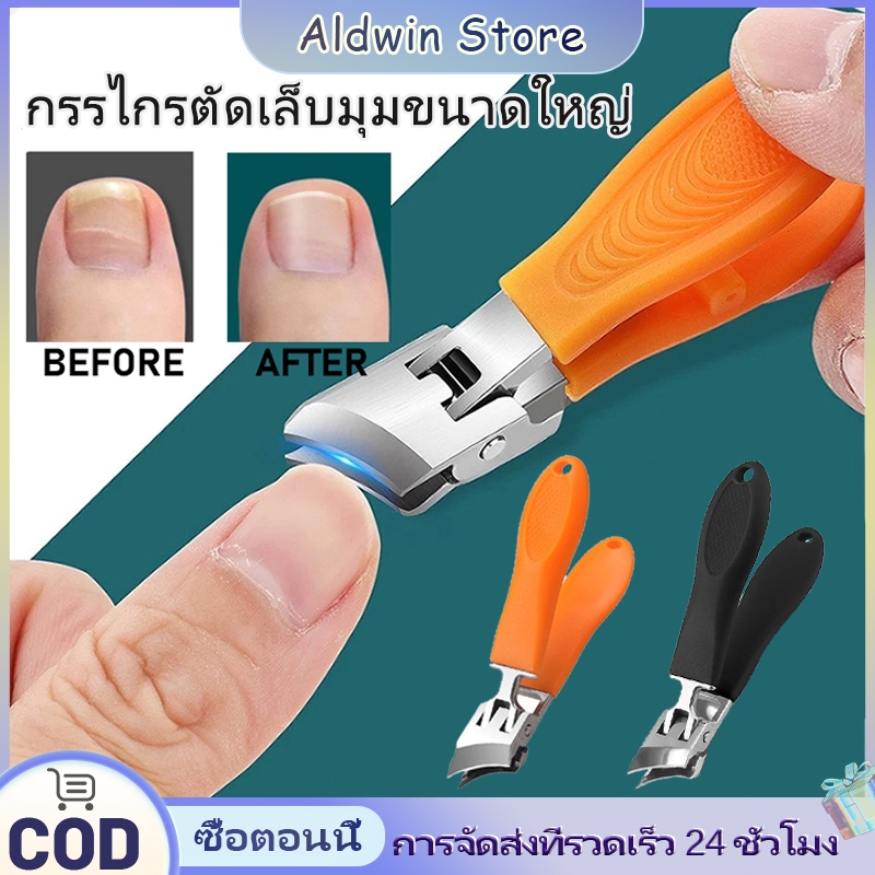 ALD กรรไกรตัดเล็บแบบเอียงป้องกันการกระเด็น ปลายแหลม ปากกว้าง อุปกรณ์จำเป็นสำหรับการรักษาเล็บขบ
