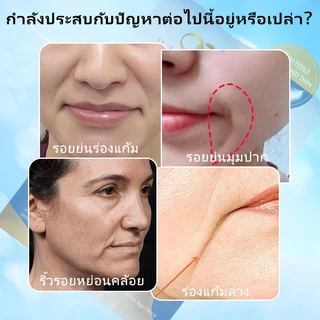 แผ่นแปะร่องแก้มต่อต้านริ้วรอย แผ่นแปะริ้วรอย ซองละ 18 แผ่น ผิวกระชับ ลดริ้วรอยลึก กับเปปไทด์เข้มข้น มาส์กหน้า