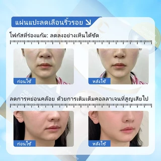 แผ่นแปะร่องแก้มต่อต้านริ้วรอย แผ่นแปะริ้วรอย ซองละ 18 แผ่น ผิวกระชับ ลดริ้วรอยลึก กับเปปไทด์เข้มข้น มาส์กหน้า