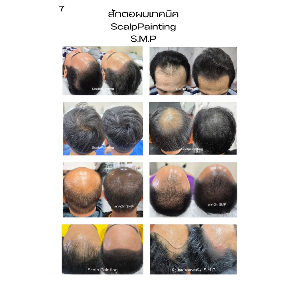 Happy สีสักตอผม scalp painting ไลเนอร์ โดยเฉพาะ. ราคา ถูกที่สุด ดีลบีเคเค แกลเลอรีภาพที่ 7