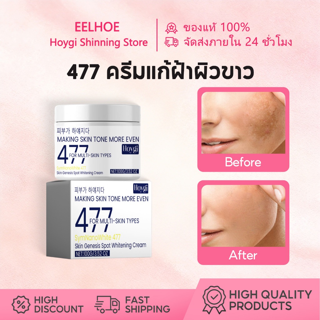 Hoygi ครีม 477 ครีมแก้ฝ้าผิวขาว ผิวขาว ลดข้อบกพร่อง บำรุงผิวโกลว์ ครีมทาหน้า บำรุงผิว ลดริ้วรอย ครีม