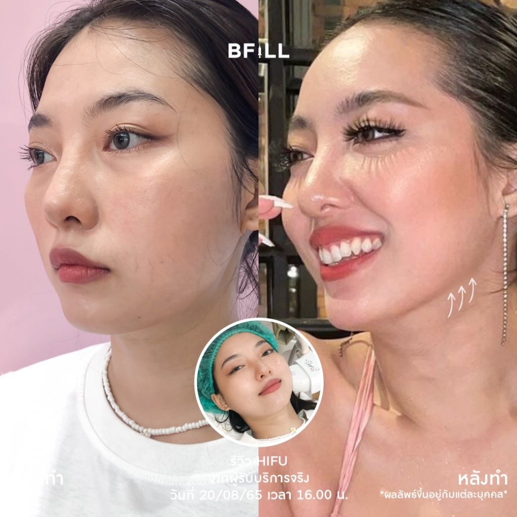 รูปภาพ 5