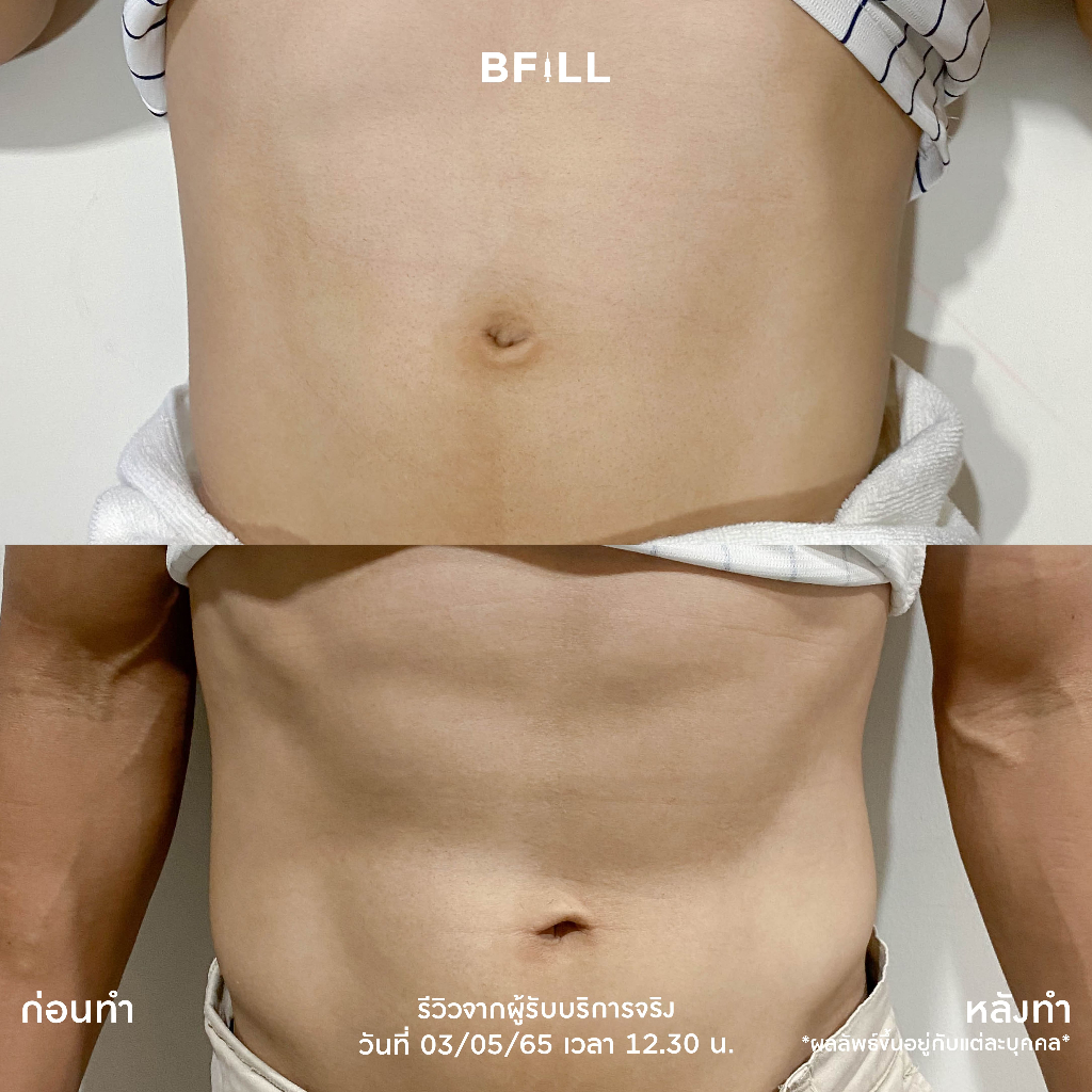 รูปภาพ 4