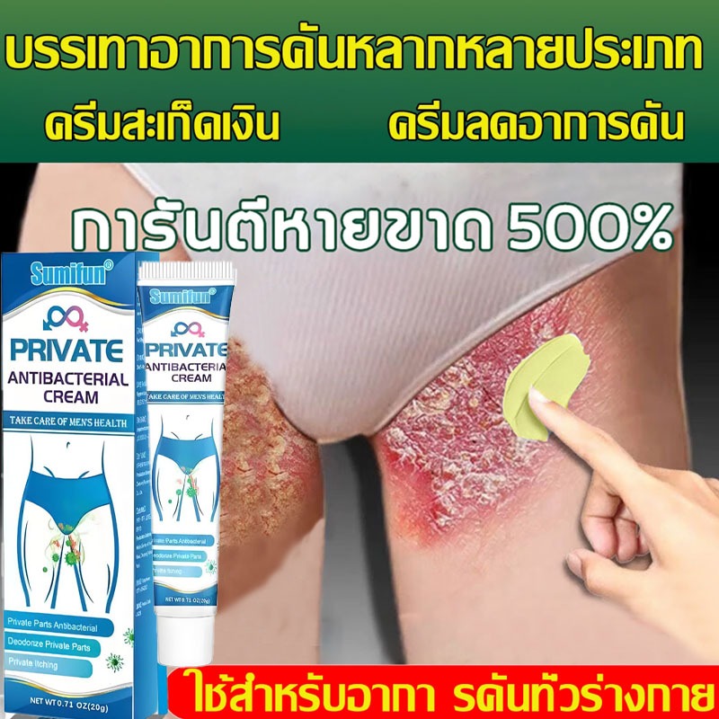 ครีมแก้คันครีมบรรเทาอาการคันบริเวณจุดซ่อนเร้นสำหรับผู้ชาย บรรเทาอาการคันบริเวณขาหนีบ ต้นขาด้านใน และบริเวณที่บอบบางอื่นๆ