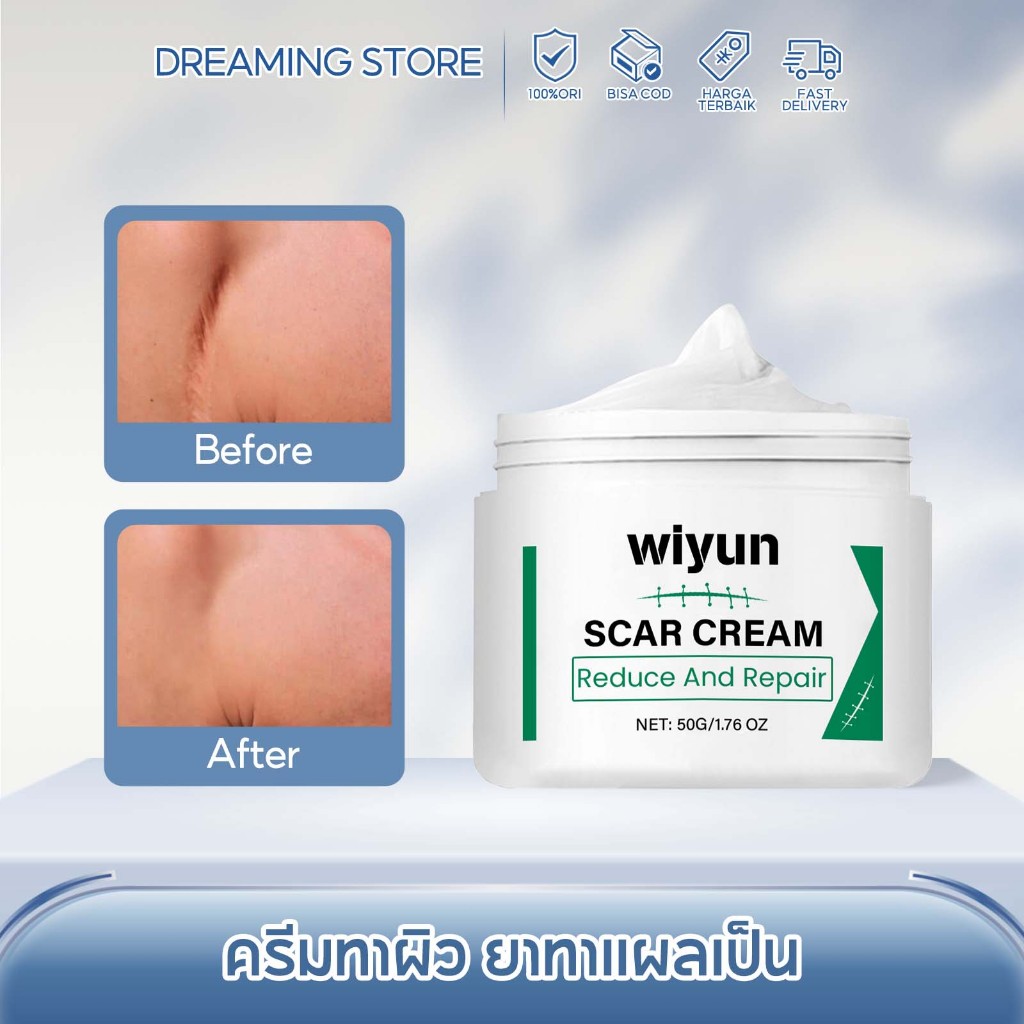 Wiyun ครีมทาผิว ยาทาแผลเป็น ลดรอย ซ่อมแซมผิวที่เสียหาย บำรุงล้ำลึก ผิวไบร์ท ชุ่มชื้น ครีมบำรุงผิวกาย