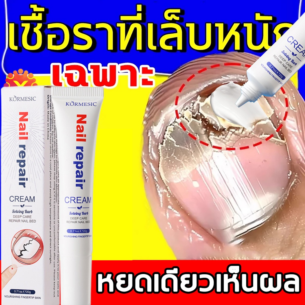 วันนี้ใช้ พรุ่งนี้ดี！เซรั่มบำรุงเล็บ เซรั่มบำรุงเล็บ แก้เชื้อราที่เล็บ บำรุงเล็บ ลากับเล็บเสีย ไม่ทำร้ายเล็บดี