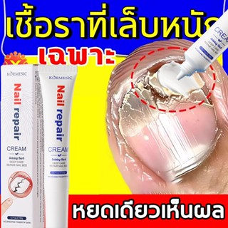 วันนี้ใช้ พรุ่งนี้ดี！เซรั่มบำรุงเล็บ เซรั่มบำรุงเล็บ แก้เชื้…