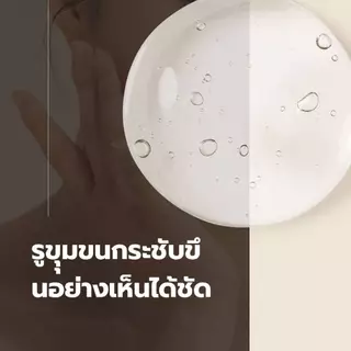 [Blanc Nature] Acne & Pore Removal Toner โทนเนอร์ลดสิว กระชับรูขุมขน ซิก้าออร์แกนิก 88%, AHA, BHA