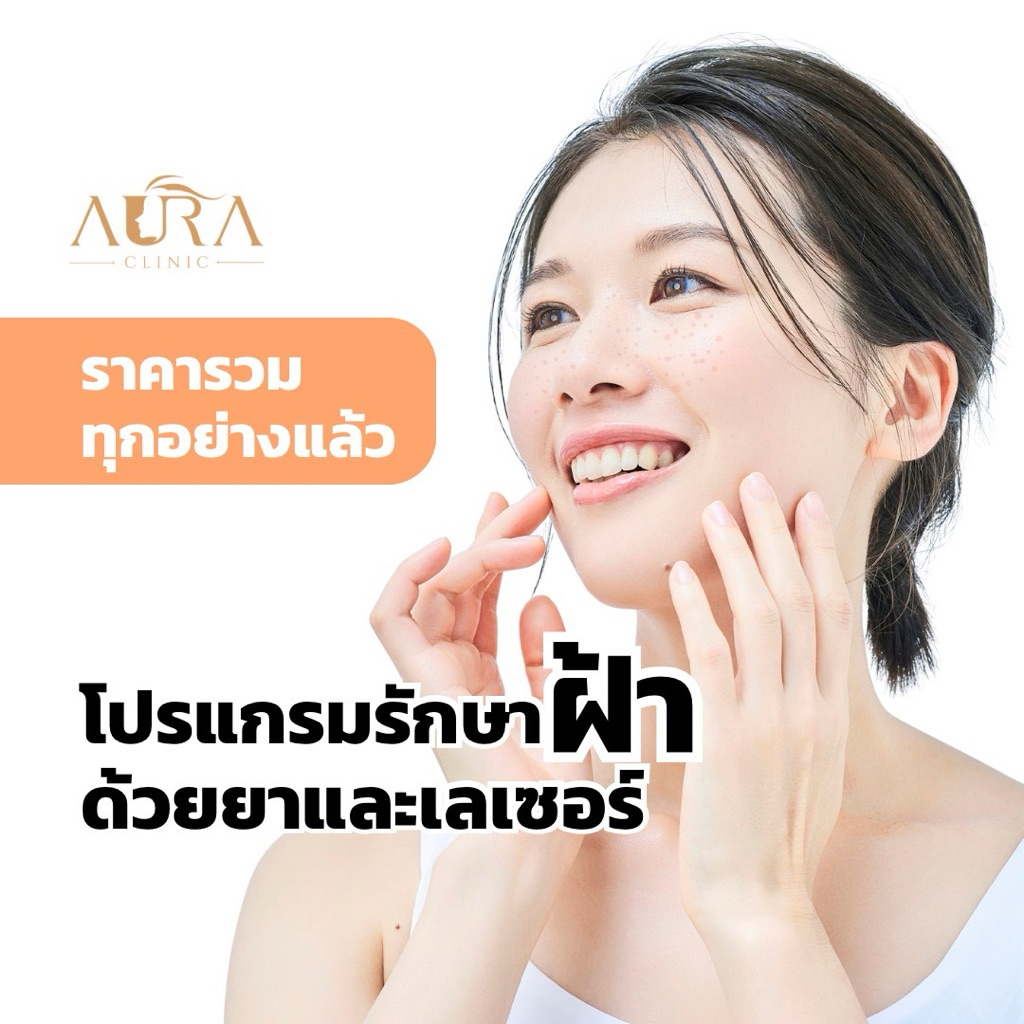 โปรแกรมรักษาฝ้าด้วยยาและเลเซอร์ 1 ครั้ง Aura Clinic เชียงใหม่(เข้ารับบริการที่คลินิก)