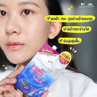 (แบบซองของแท้) มอยส์เซรั่ม และ เมลาสม่าทาฝ้า 10-13 กรัม x6 ซอง Zolution Moist Tank Extra&Serum
