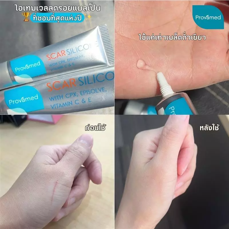 PROVAMED SCAR SILICONE 10g โปรวาเมด สการ์ ซิลิโคน ดูแลรอยแผลเป็น thumbnail 5