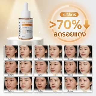 POPASKIN 10% Niacinamide Brightening Serum เซรั่มผิวขาว ผิวขาวใส กระจ่างใส ลดหมองคล้ำ ลดฝ้า ลดรอยดำ ลดรอยสิว 30ML