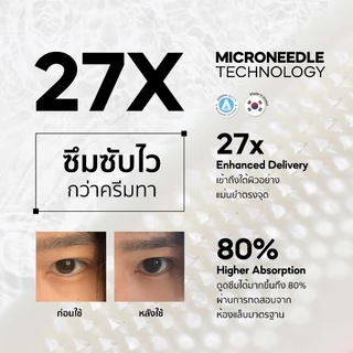 The Awesome Patch – กู้รอยคล้ำใต้ตาแบบเร่งด่วน มาร์กเข็มลดริ้วรอย ไมโครนีดเดิล 1,800 เข็ม | By Moonshot Labs (Pack 1)