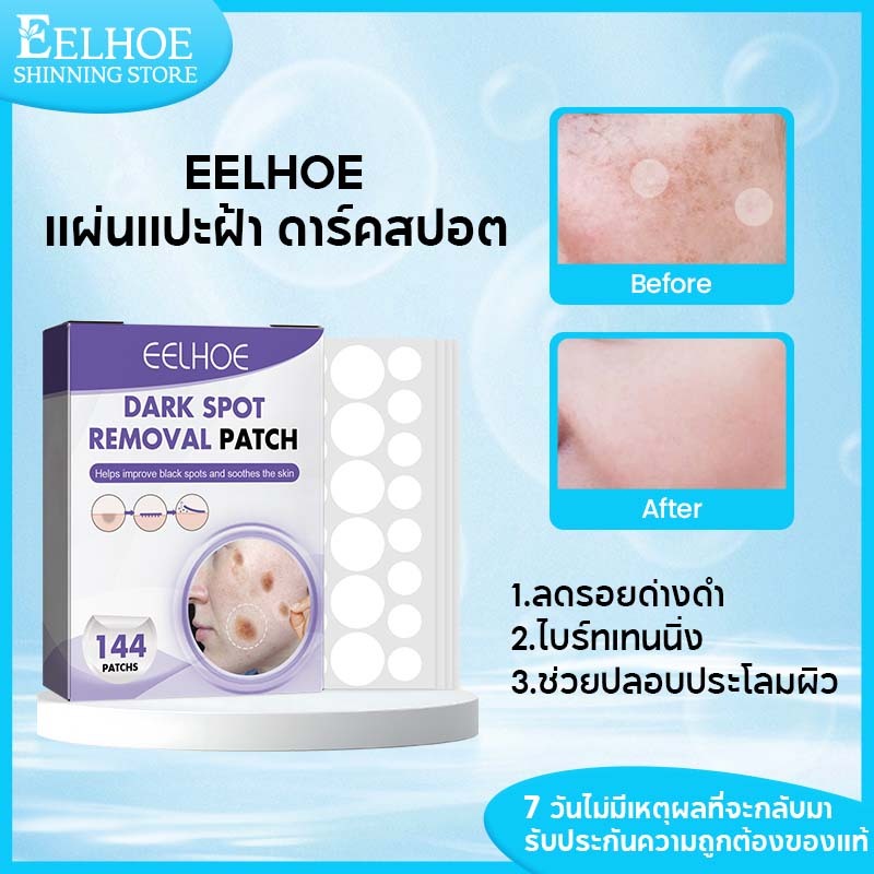 EELHOE แผ่นแปะฝ้า ดาร์คสปอต Dark Spot Patch ช่วยลดเลือนฝ้า กระ รอยสิว แก้ฝ้าทุกชนิด แผ่นแปะลดรอยสิว