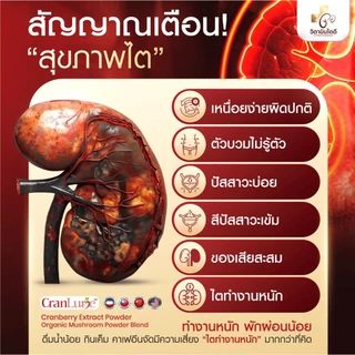MYCO Prime Plus (1แถม1) ผลิตภัณฑ์เสริมอาหาร วิตามินบำรุงไต ดูแลสุขภาพไต เสริมการทำงานของไต