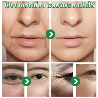 เซรั่ม กระชับ เซรั่มหน้าใส นริ้ว รอย ตีนกา ริ้วรอยริ้ว เซรั่มต่อต้านริ้วรอย อุดมไปด้วยกรดไฮลูโรนิก ไวท์เท 30ml