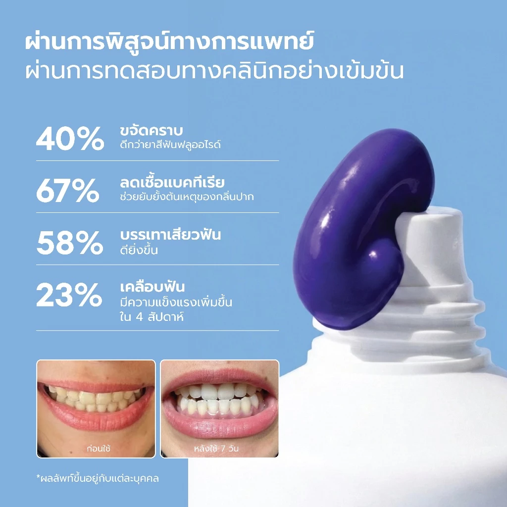 Linee Aura White ยาสีฟันลดคราบเหลือง ฟอกฟันขาว 3in1 thumbnail 6