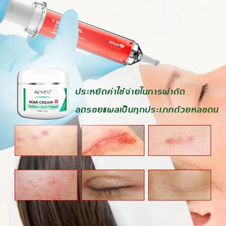 [ของแท้ 100%] ALIVER ครีมลดรอยแผลเป็น แผลเป็นนูนหนา แผลเป็นถลอก เร่งการซ่อมแซมให้ผิว ครีมแผลเป็น ลดแผลเป็น ยาทาแผลเป็น